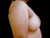 Patient # 34790 After Photo # 4